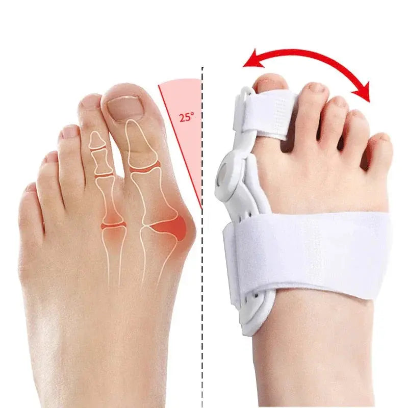 2Pcs Hallux Valgus Corrector Juanetes Para Dedos Tienda
